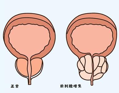 前列腺凝胶工厂