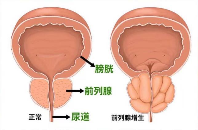 前列腺凝胶OEM厂家