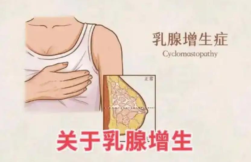 乳腺膏定制厂家